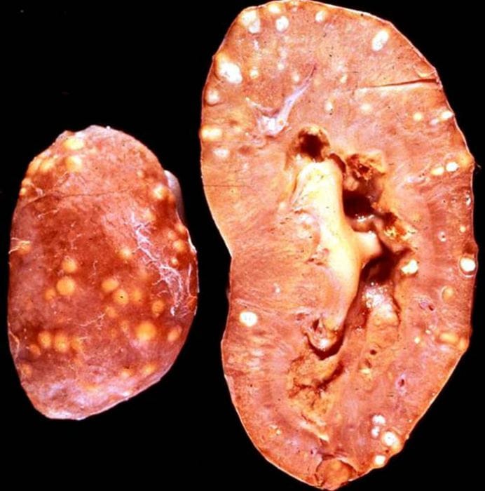 Első